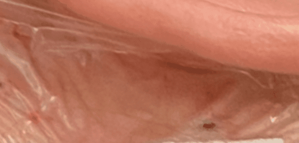 Figure 6 MVD Resized 2