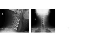 Your paragraph text (3)